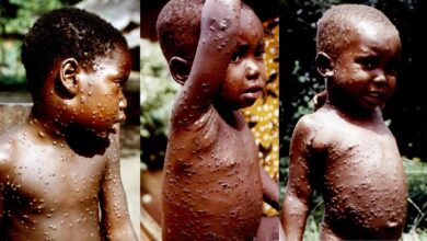 Monkeypox virus (Photo credit: HarryKeayn.blogspot.com